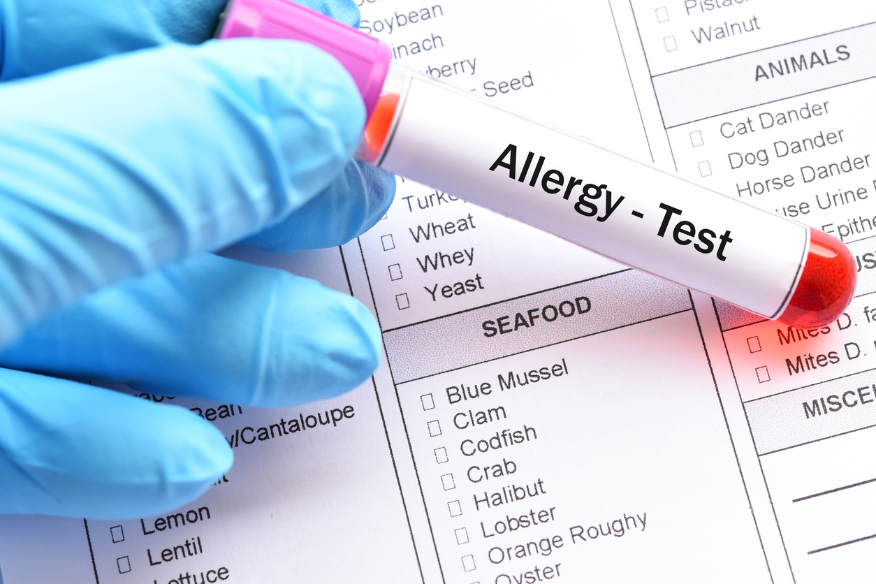 Understanding the ALEX³ Allergy Test: A Modern Approach to Diagnosing ...