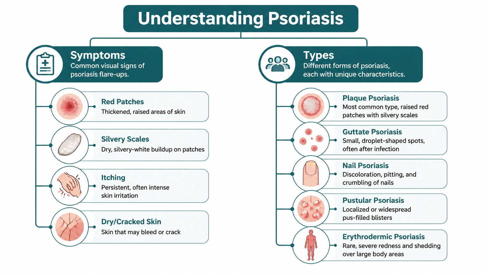 An infographic titled Understanding Psoriasis that displays common symptoms and different types of the skin condition.