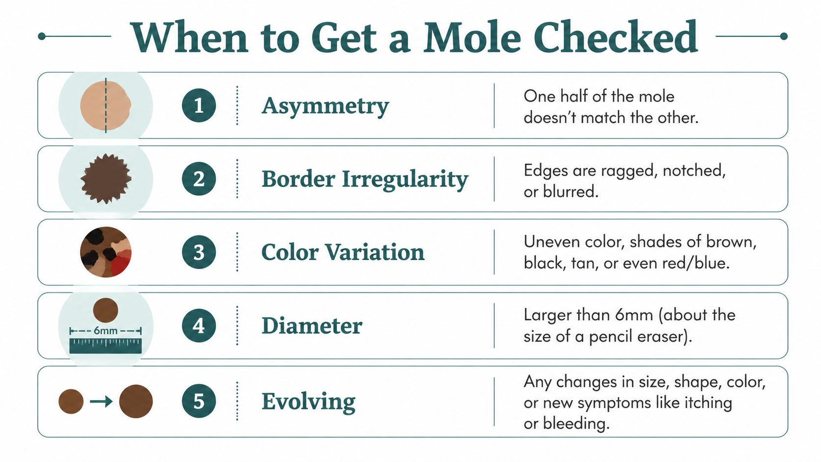 An educational infographic showing the five warning signs of melanoma to help identify when to check a mole.