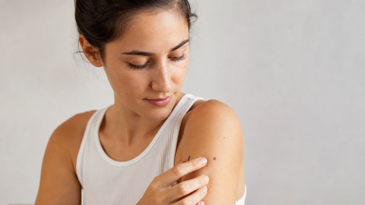 Understanding Common Skin Lesions
